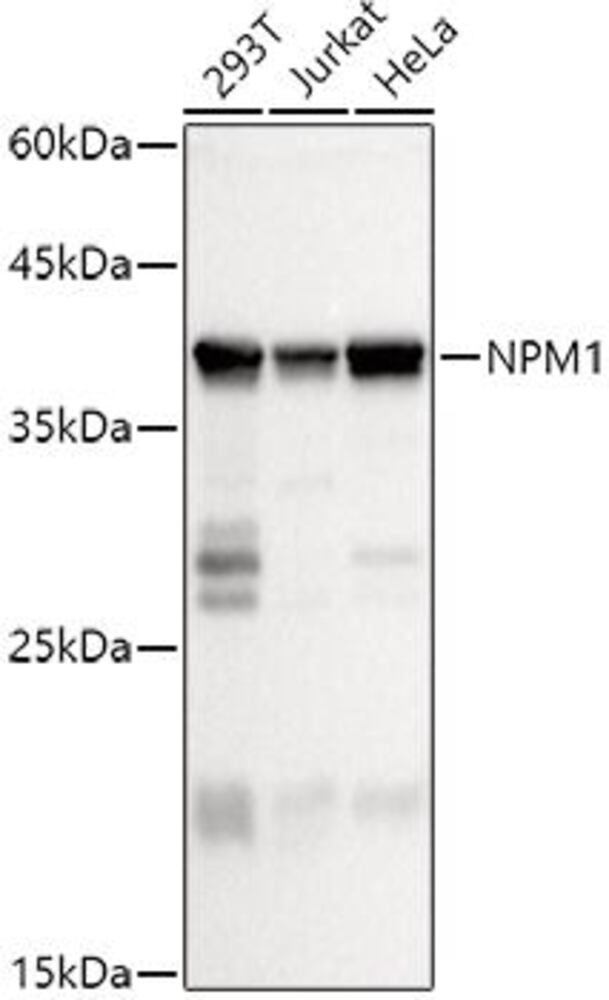 Anti-Nucleophosmin Antibody, 100 µl - Luminix Health