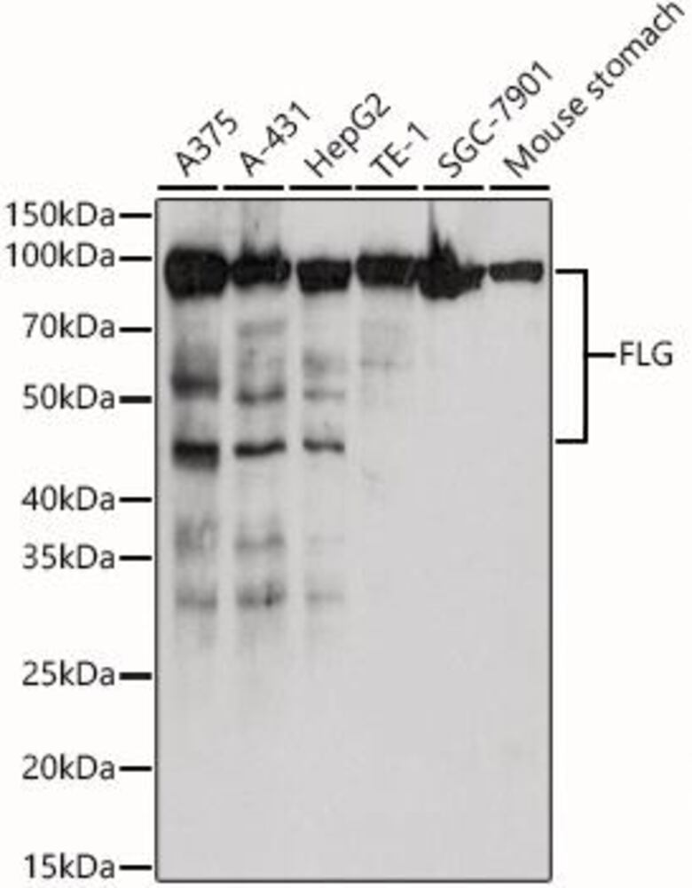 Anti-Filaggrin Antibody, 100 µl - Luminix Health