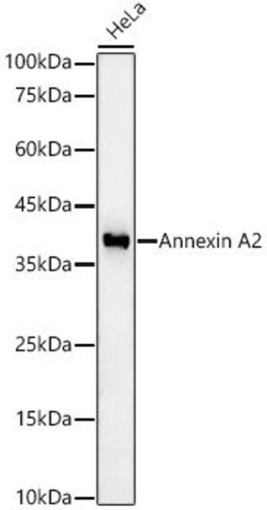 Anti-Annexin-2 / ANXA2 Antib [ARC59617], 100 µl - Luminix Health