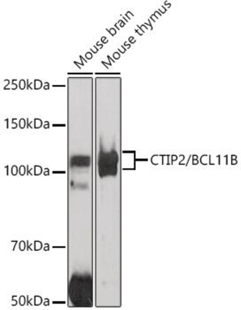 Anti-Ctip2 Antibody, 100 µl - Luminix Health