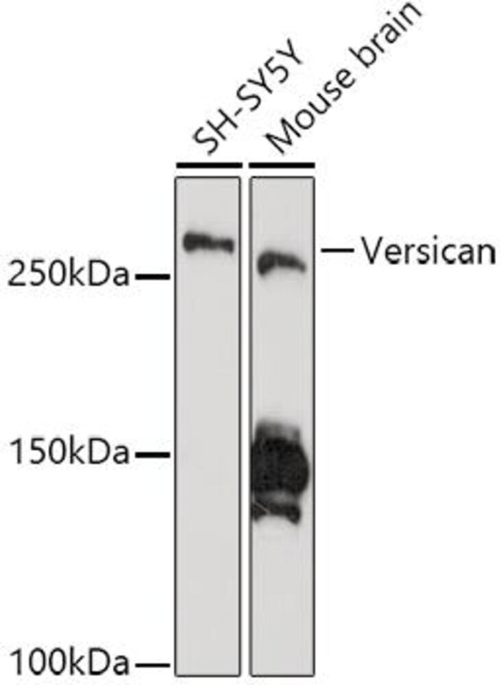 Anti-Versican Antibody [ARC2216], 100 µl - Luminix Health