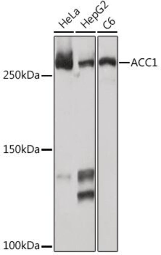 A-Acetyl CoenzA carboxyla a Ant[ARC2201], 100 µl - Luminix Health