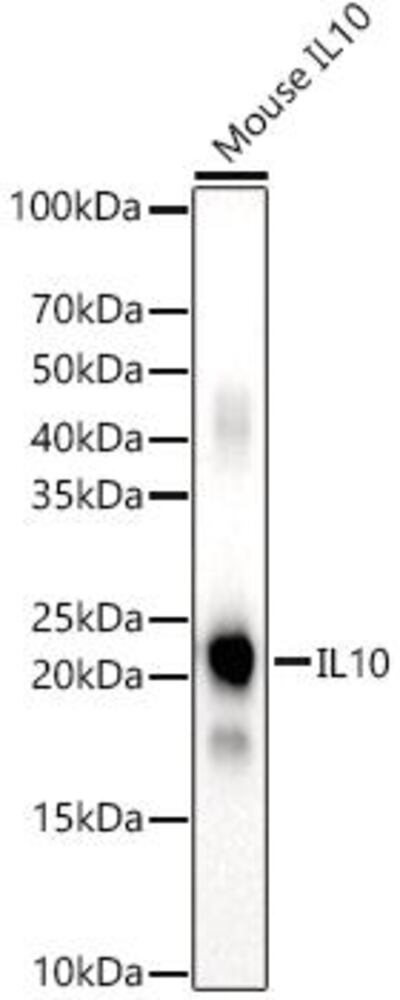 Anti-IL-10 Antibody, 100 µl - Luminix Health