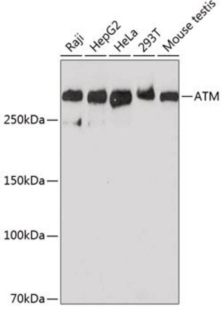 Anti-ATM Antibody [ARC0129], 100 µl - Luminix Health