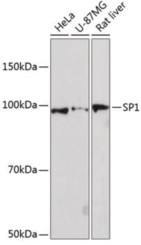 Anti-SP1 Antibody [ARC0128], 100 µl - Luminix Health