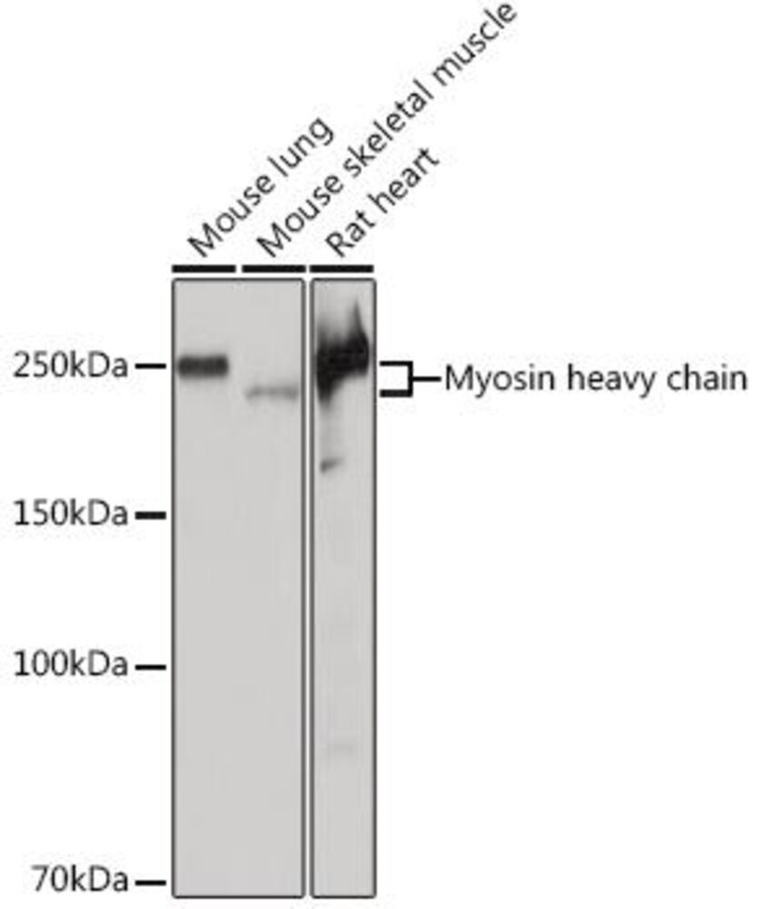 Anti-Myosin heavy chain Antib [ARC1170], 100 µl - Luminix Health