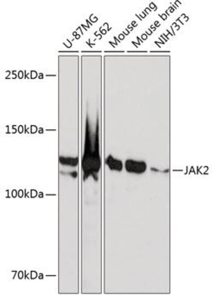 Anti-JAK2 Antibody [ARC0108], 100 µl - Luminix Health