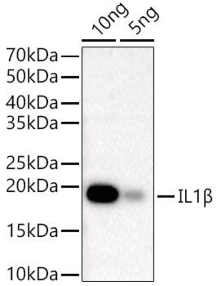 Anti-IL-1 beta Antibody [ARC56180], 100 µl - Luminix Health