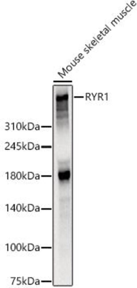 Anti-Ryanodine Receptor Antibody, 100 µl - Luminix Health