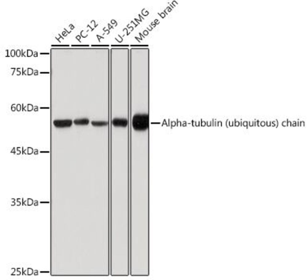 Anti-Tubulin Antibody, Density (D) 1 g/cm³, Storage temp. +4 °C - Luminix Health