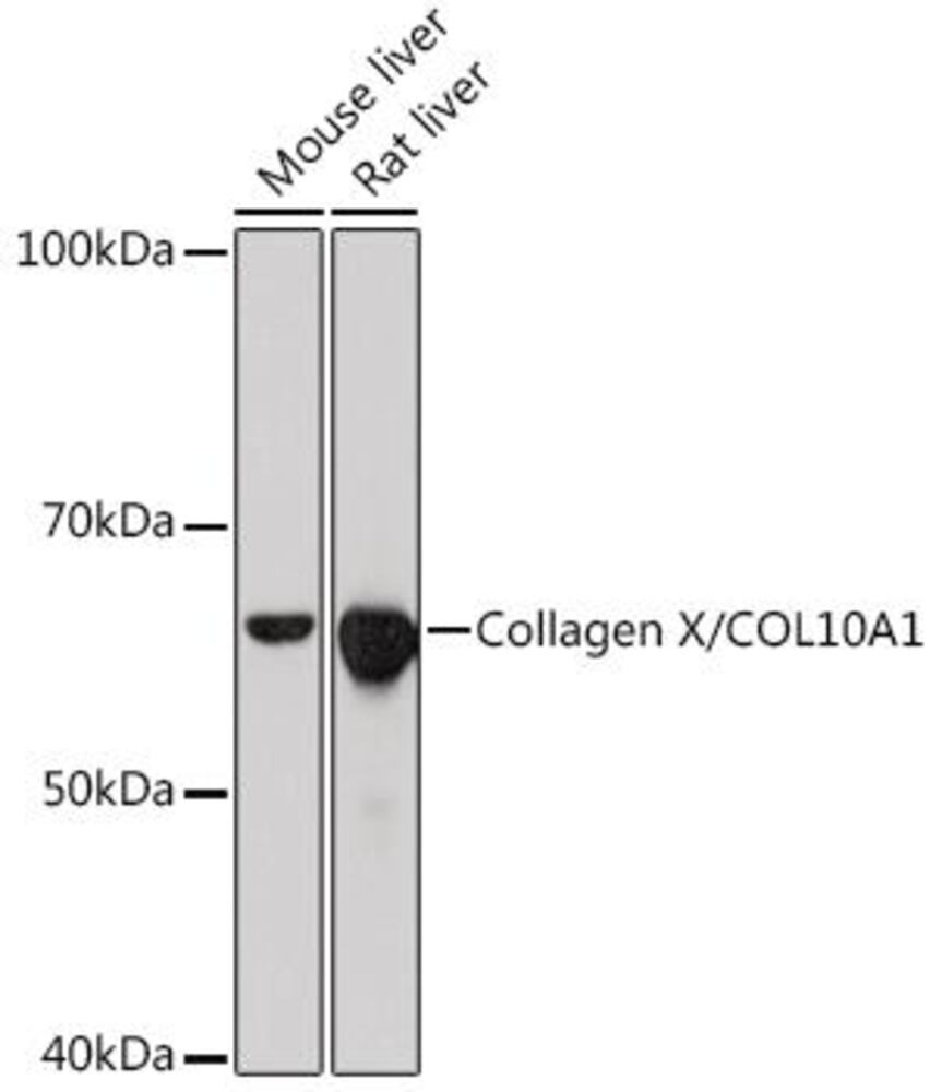 Anti-Collagen X Antibody [ARC0659], 100 µl - Luminix Health