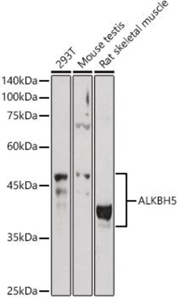 Anti-ALKBH5 Antibody, 100 µl - Luminix Health