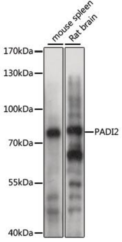 Anti-PADI2 / PAD2 Antibody, 100 µl - Luminix Health