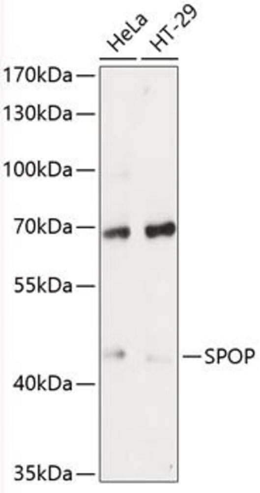 Anti-SPOP Antibody, 100 µl - Luminix Health