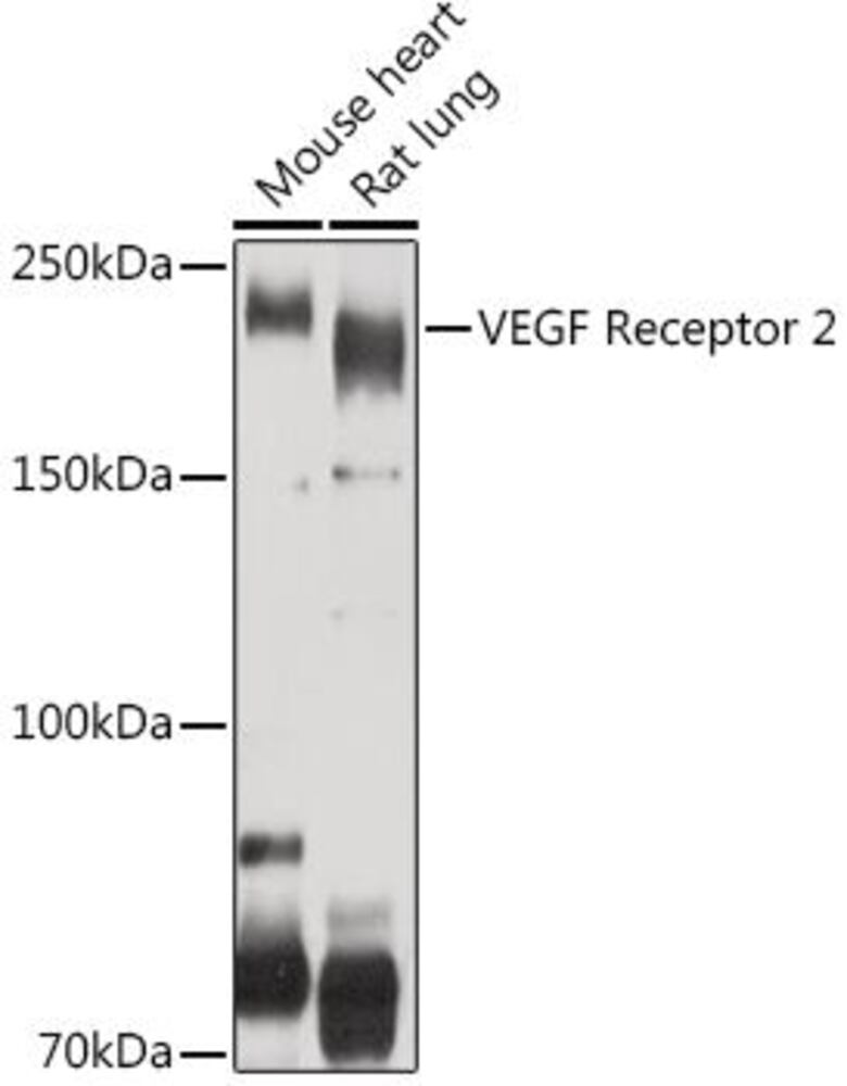 Anti-VEGF Receptor 2 Antibody, 100 µl - Luminix Health
