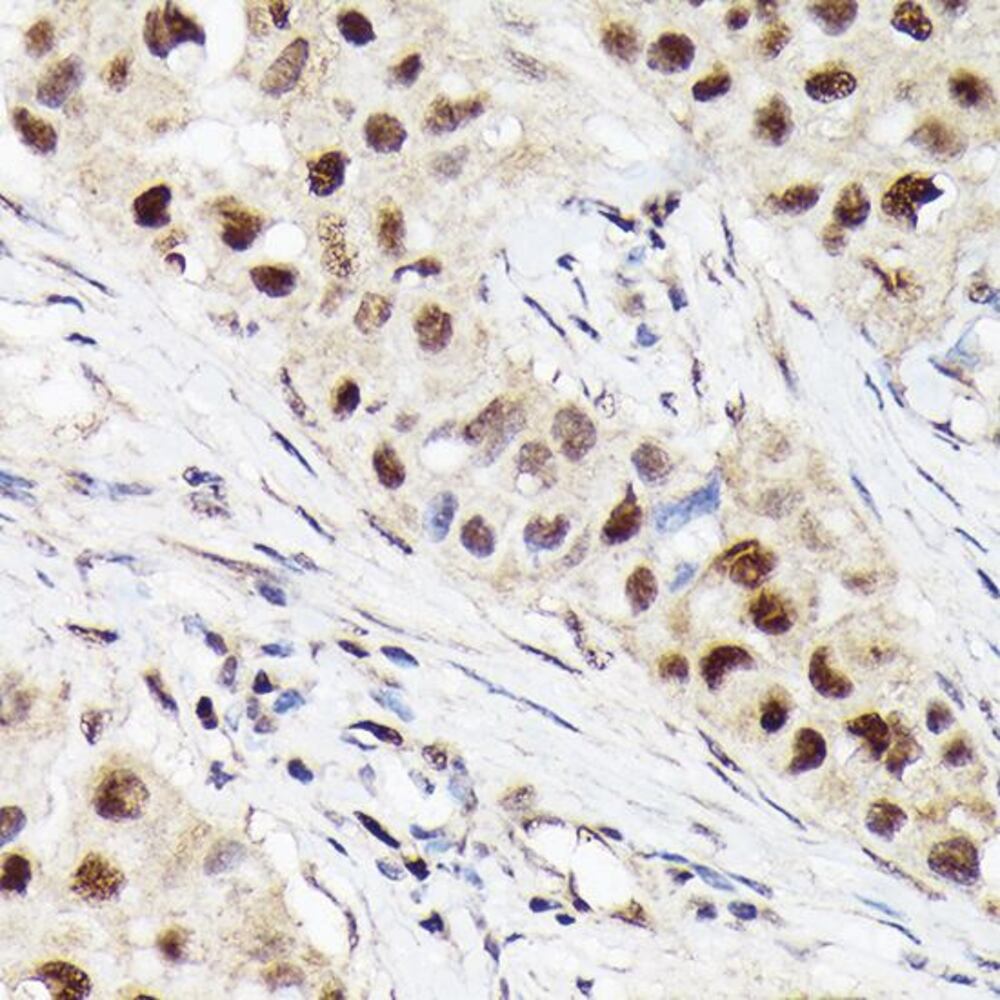 Anti-Cdk4 Antibody [ARC51004], 100 µl - Luminix Health