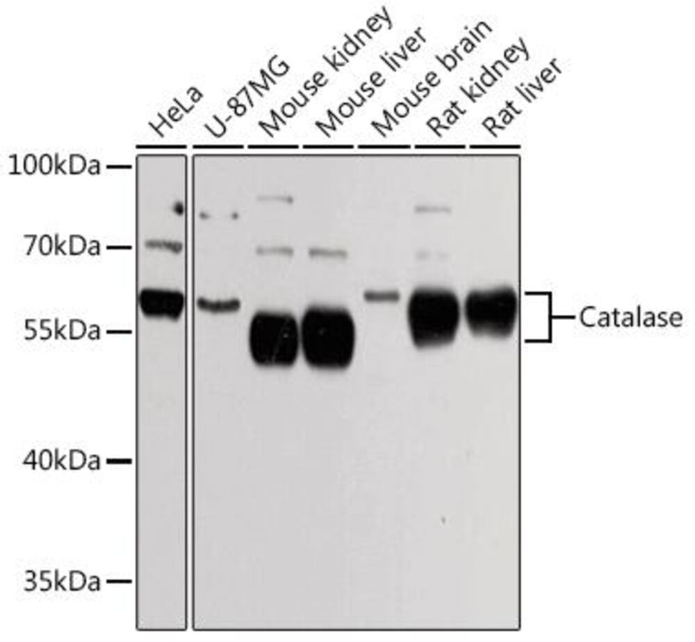 Anti-Catalase Antibody, 100 µl - Luminix Health