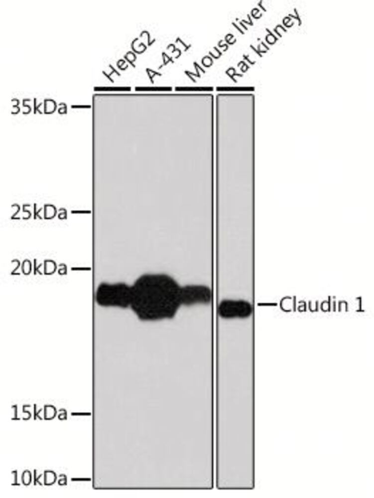 Anti-Claudin 1 Antibody [ARC54478], 100 µl - Luminix Health