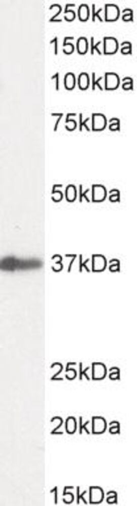 Anti-SIAH1 Antibody, 100 µg - Luminix Health