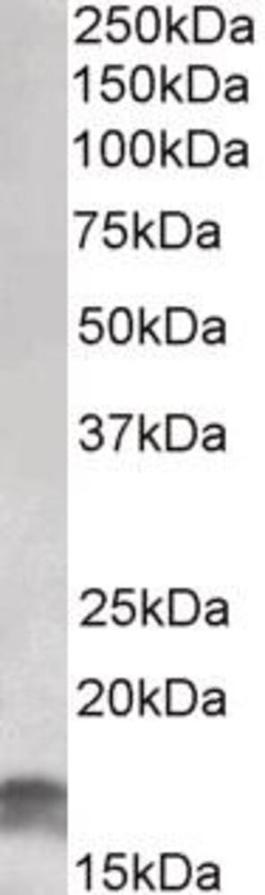Anti-CDKN2A/p16INK4A Antibody, 100 µg - Luminix Health