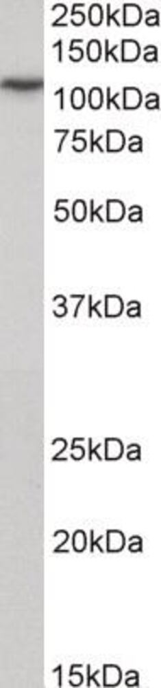 Anti-PSD95 Antibody, 100 µg - Luminix Health