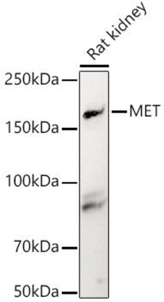 Anti-Met (c-Met) Antibody, 100 µl - Luminix Health