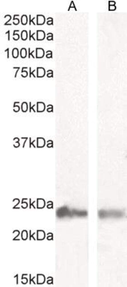 Anti-Transgelin Antibody, 100 µg - Luminix Health
