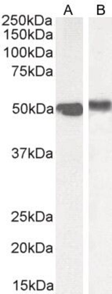Anti-FOXA1 Antibody, 100 µg - Luminix Health