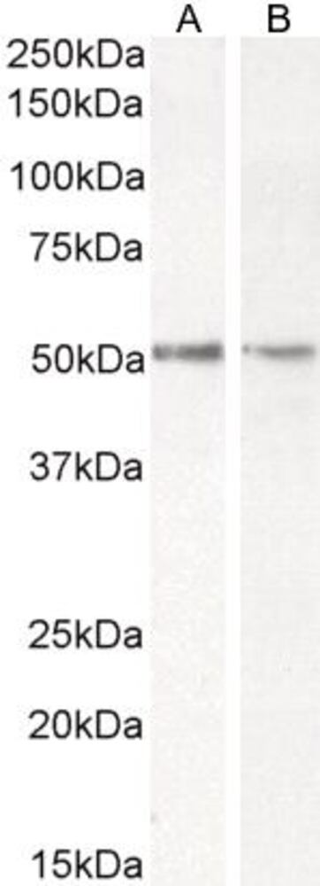 Anti-Chromogranin A Antibody, 100 µg - Luminix Health