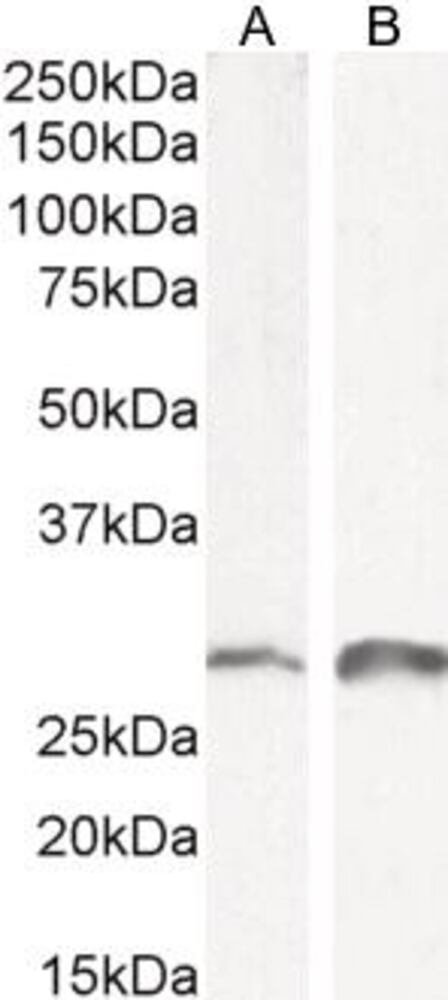 Anti-SNAI1 Antibody, 100 µg - Luminix Health