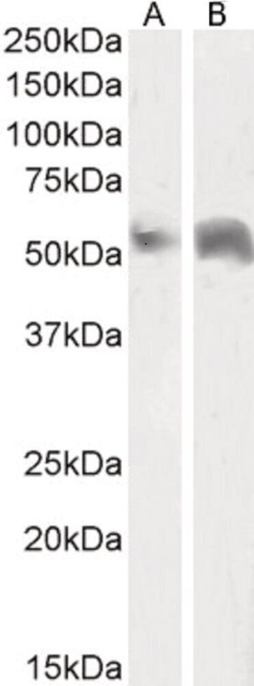 Anti-Perilipin-1 Antibody, Density (D) 1 g/cm³, Storage temp. +4 °C - Luminix Health