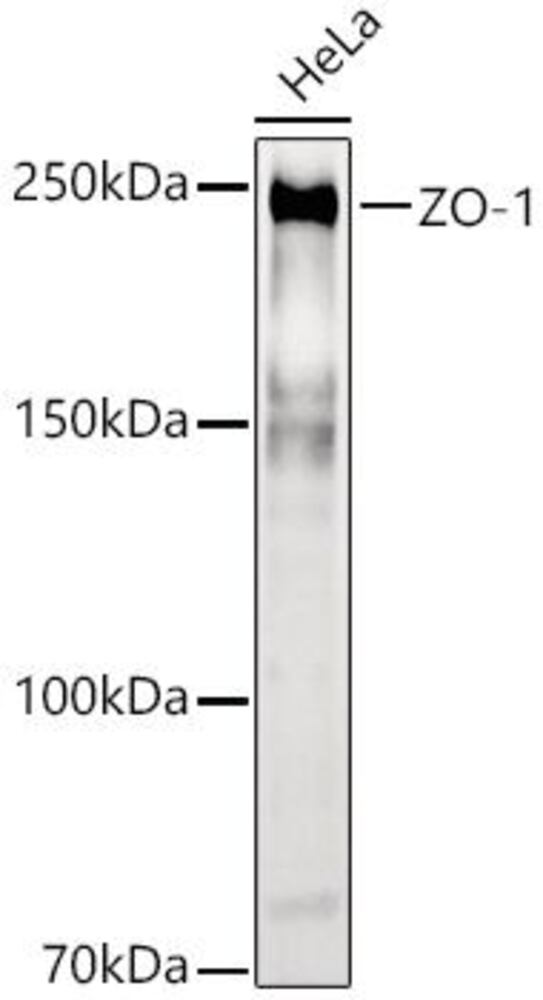 Anti-ZO1 tight junction protein Antibody, 100 µl - Luminix Health