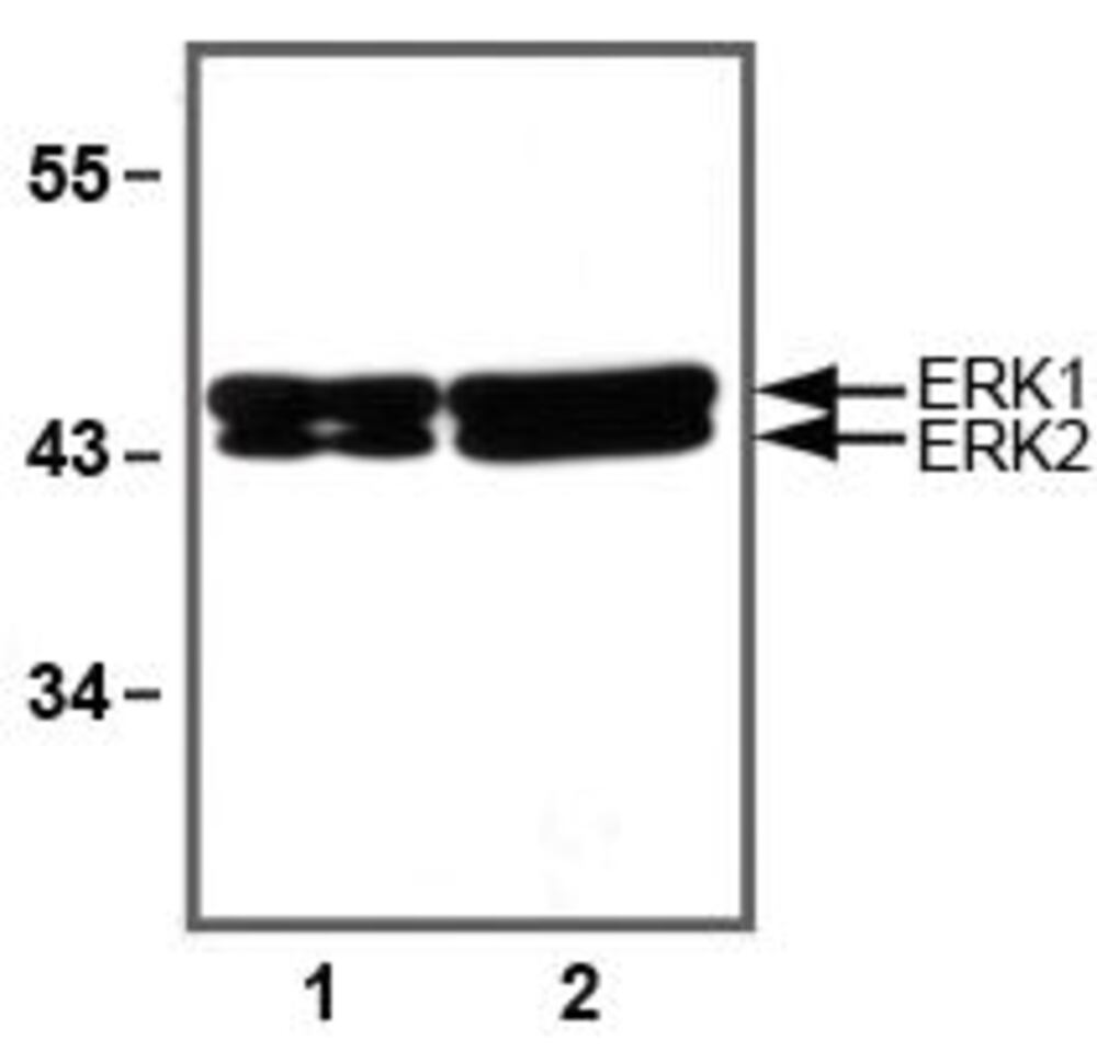 Anti-ERK1 + ERK2 Antibody [E31R], 100 µg - Luminix Health