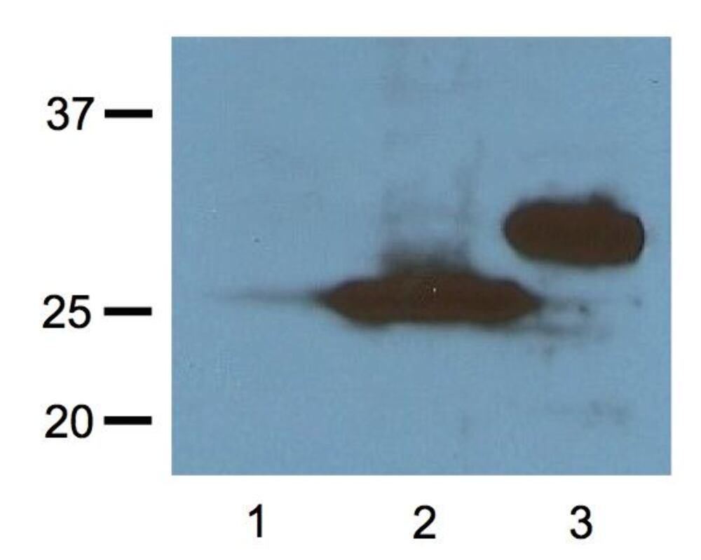 Anti-RFP Tag Antibody [RF5R], 100 µg - Luminix Health