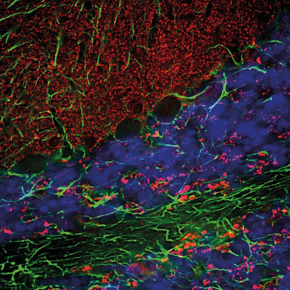 Anti-alpha Synuclein Antibody, 50 µl - Luminix Health