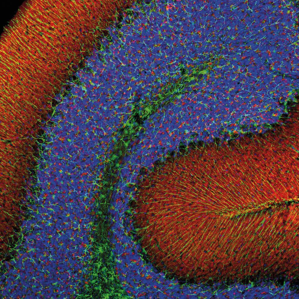 Anti-alpha Synuclein Antibody [2A7], 50 µl - Luminix Health
