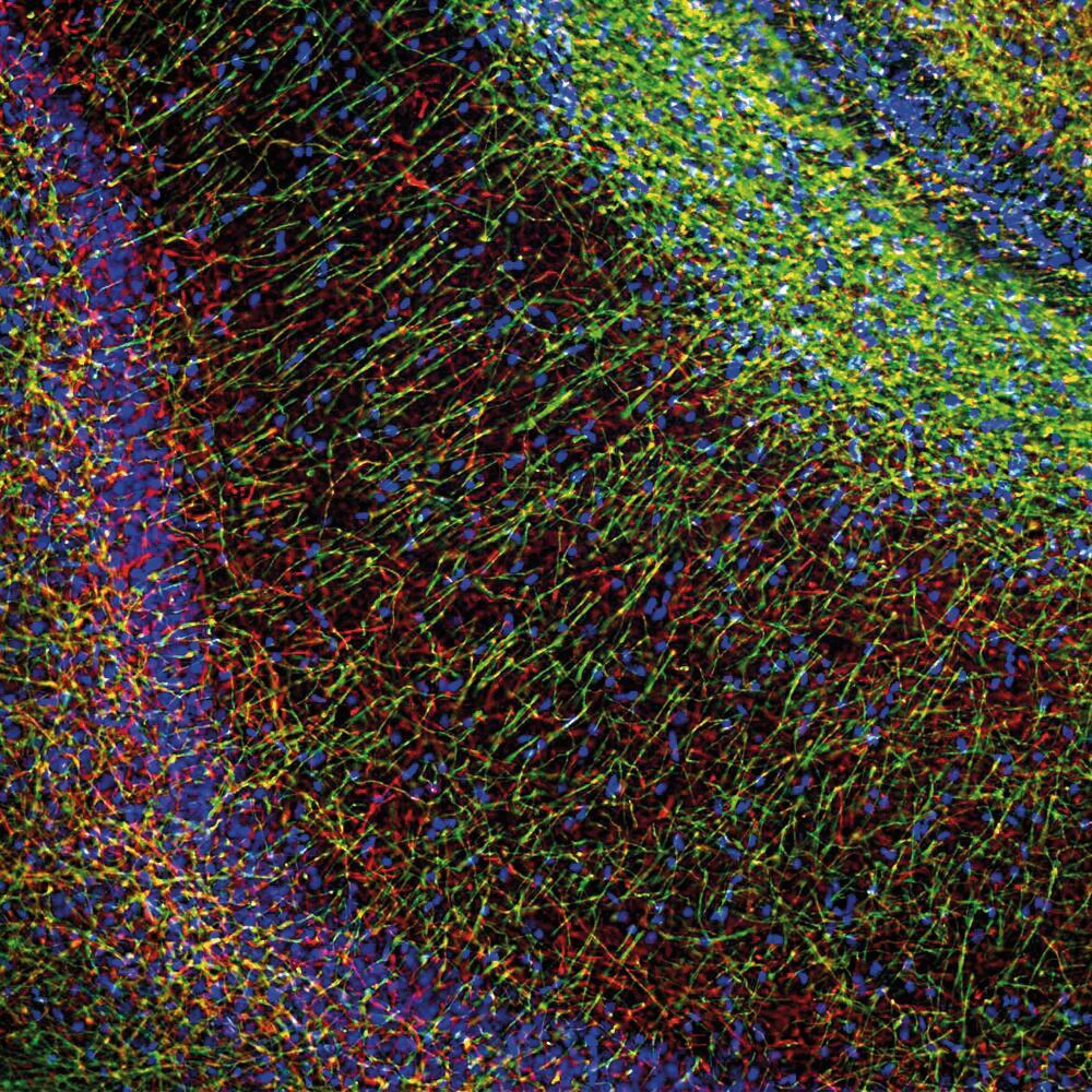 Anti-Myelin Basic Protein Antibody [7G7], 50 µl - Luminix Health