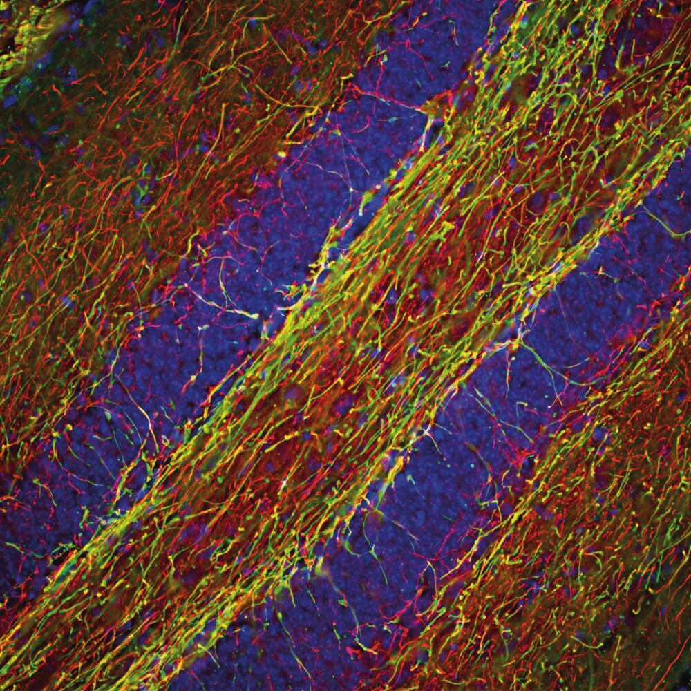Anti-NF-H Antibody, 50 µl - Luminix Health