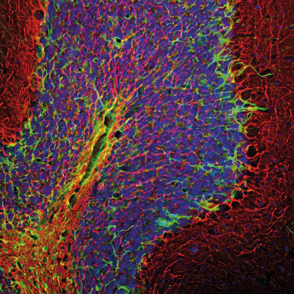 Anti-NF-H Antibody, 25 µl - Luminix Health