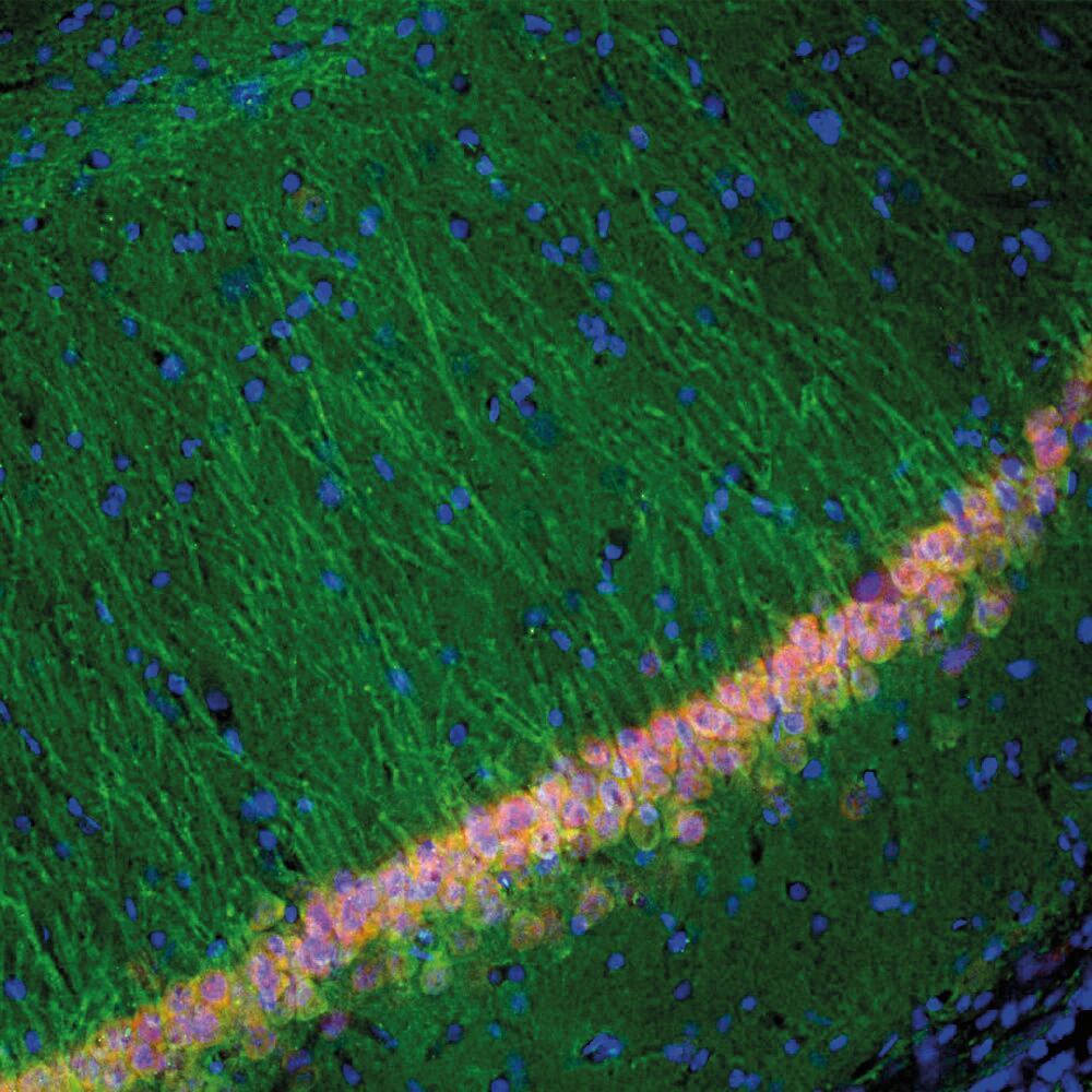 Anti-UCHL1 Antibody [BH7], 50 µl - Luminix Health
