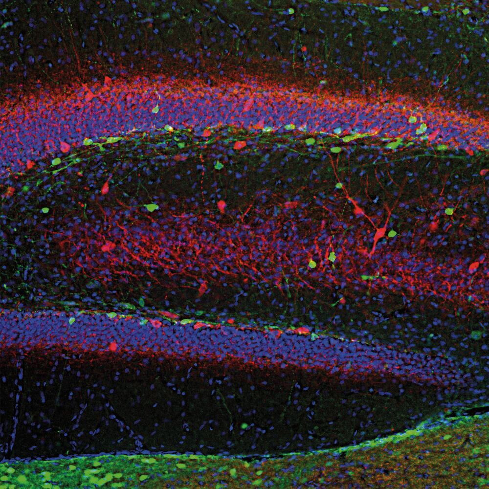 Anti-Calretinin Antibody [6A9], 50 µl - Luminix Health