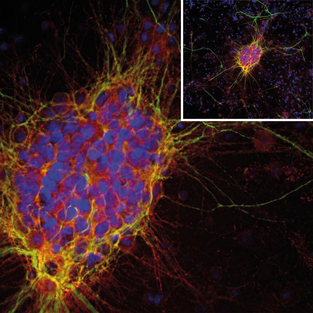 Anti-Doublecortin Antibody [3E1], 50 µl - Luminix Health
