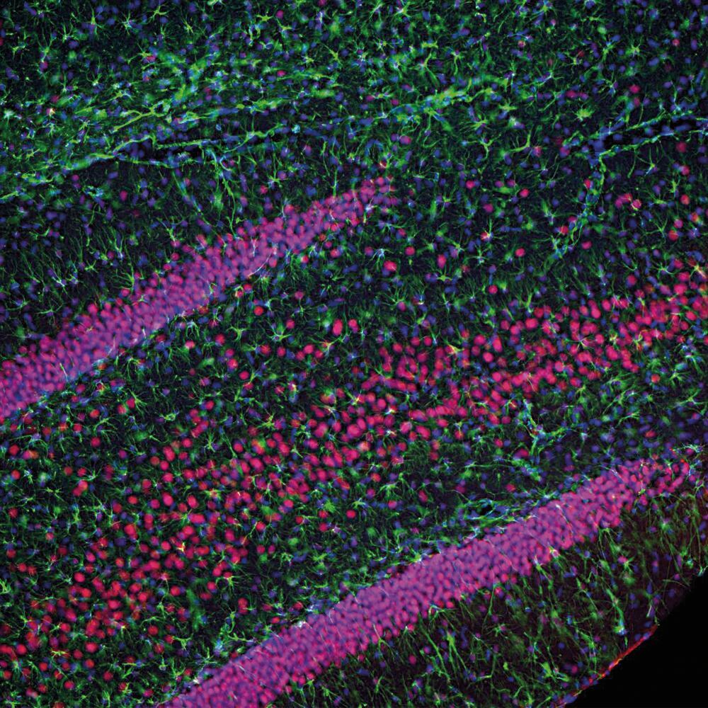 Anti-TDP43 Antibody [3H8], 50 µl - Luminix Health