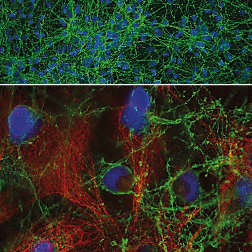 Anti-GAP43 Antibody, 50 µl - Luminix Health