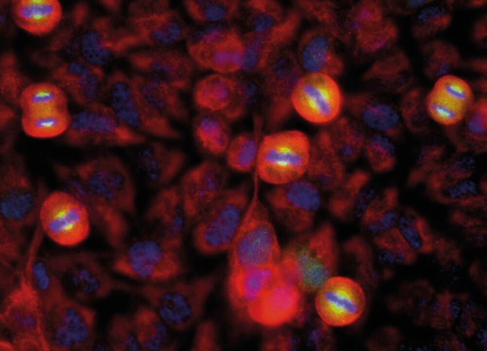 Anti-Aurora A Kinase Antibody [1A11], 50 µl - Luminix Health