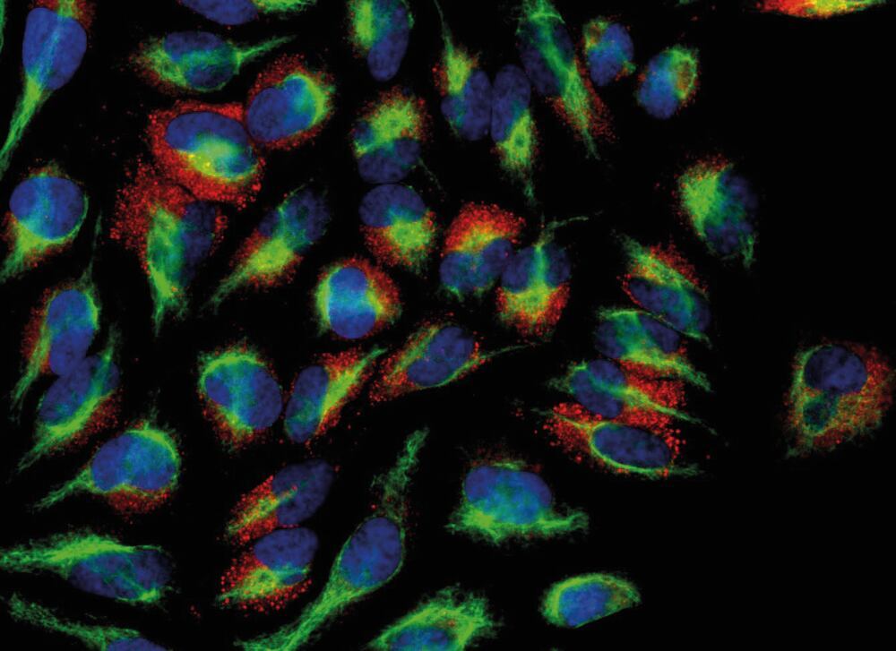 Anti-Calreticulin Antibody [6C6], 50 µl - Luminix Health