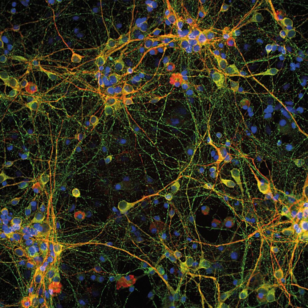 Anti-Tau Antibody, 50 µl - Luminix Health