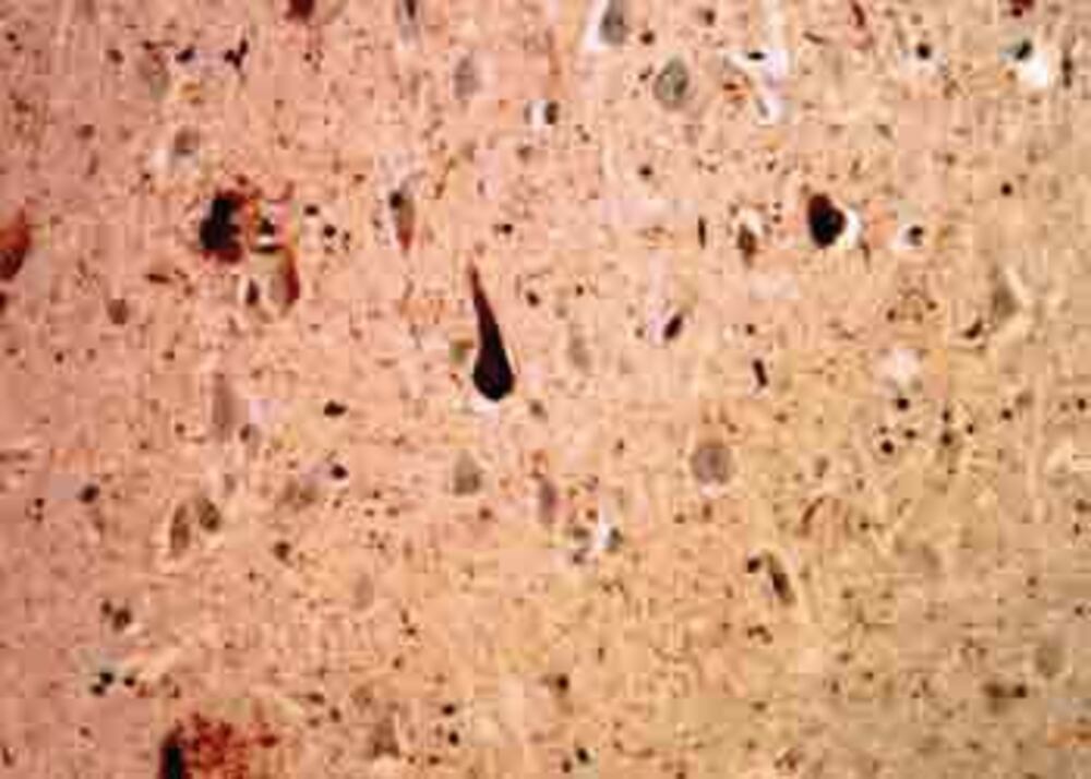 Anti-Ubiquitin Antibody [Ubi-1], 50 µl - Luminix Health