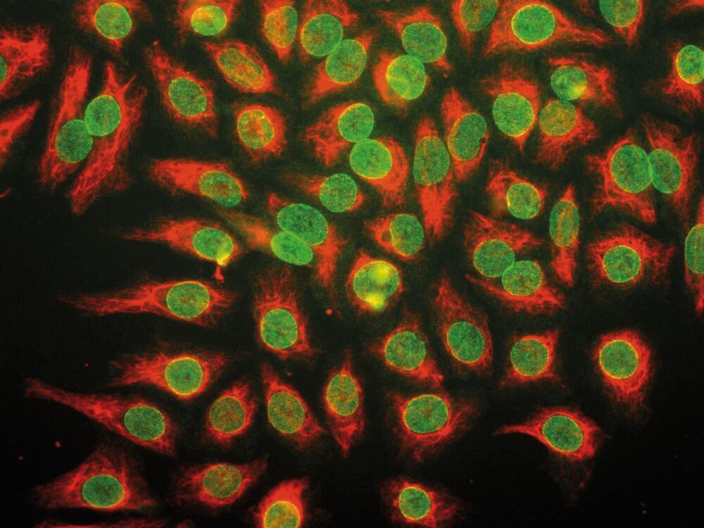 Anti-Nuc Pore Complex Prot Antib [39C7], 50 µl - Luminix Health