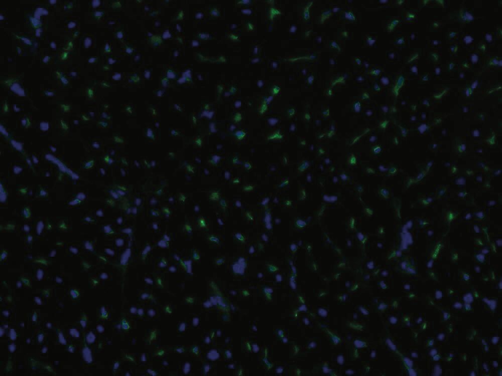 Anti-CD105 Antibody [MEM-229], 100 µg - Luminix Health